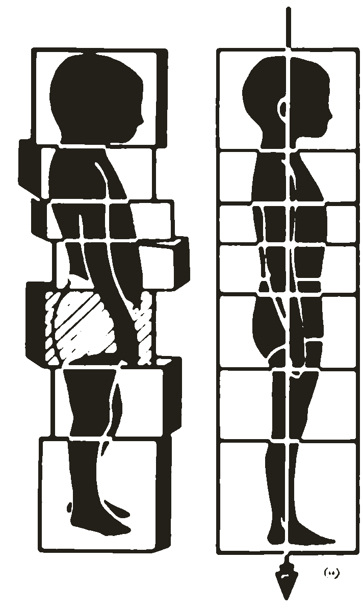 The Rolfing® 'little boy' logo — the same body before and after structural integration